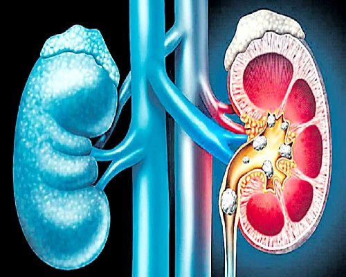 Kidney