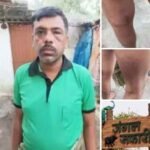 Employee Violence: जंगल सफारी कर्मचारी की थाने में पिटाई से हड़कंप, कर्मचारी संघ ने किया विरोध