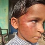 Teacher Spanking : दूसरी कक्षा के मासूम छात्र की बेरहमी से पिटाई