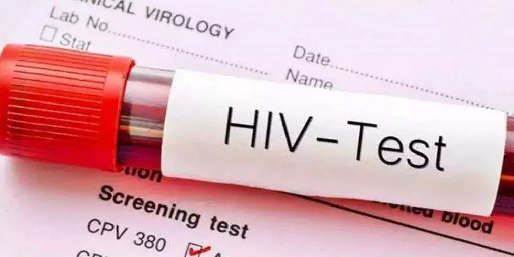 Chhattisgarh HIV Case