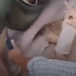 CG NEWS : जबरदस्त पिटाई में व्यक्ति को 80 से ज्यादा चोटें, डॉक्टर बोले– शरीर का कोई हिस्सा सुरक्षित नहीं