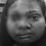 Brutality In A Beer Bar : बॉयफ्रेंड ने शराब की बोतल से गर्लफ्रेंड का सिर कुचला, 23 दिन बाद इलाज के दौरान मौत