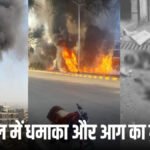 Airstrike on Kabul : काबुल में एयरस्ट्राइक से कोहराम’ अस्पताल पर गिराए बम, 400 से ज्यादा की मौत का दावा