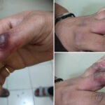 CG NEWS : लाइब्रेरी में पढ़ाई कर रहे छात्र की जेब में फटा मोबाइल, धमाके के साथ लगी आग; छात्र गंभीर रूप से झुलसा