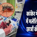CG News : कांकेर में मलेरिया का कहर’ 2 दिन में 2 छात्रों की मौत, सरकारी हॉस्टलों के 11 छात्र संक्रमित, स्वास्थ्य विभाग अलर्ट