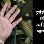 Meaning of a mole on the palm : हथेली पर तिल देता है शुभ या अशुभ संकेत? जानिए क्या कहते हैं ज्योतिष विशेषज्ञ