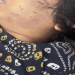 CG Crime : रायपुर में B.Ed छात्रा की हत्या, लिव-इन पार्टनर पर गला घोंटकर मारने का आरोप, अस्पताल में छोड़कर हुआ फरार